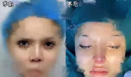 整容爆料视频,视频爆料揭露美丽背后的代价