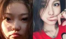 整容爆料视频,视频爆料揭露美丽背后的代价